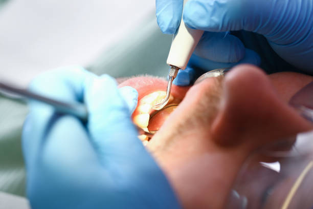 Best Emergency Dental Surgery in Ponder, TX